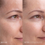 KOJIC ALTERNATIVE Kojik Asit Alternatifi Bitki Bazlı Pigment Serumu